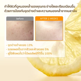 SOME BY MI Yuja Niacin Anti-Blemish Cream [60g], ลดรอยสิว, ครีมเพิ่มความชุ่มชื้น