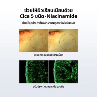 [ส่งจากคลัง beplain] Beplain CICA เซรั่มพีดีอาร์เอน(PDRN) 30ml | ซ่อมแซมและฟื้นฟูผิวที่เสื่อมโทรม | ผิวเงาสุขภาพดี ฉ่ำน้ำ | เสริมสร้างเกราะป้องกันผิว | CICA PDRN SKIN BOOSTER SERUM