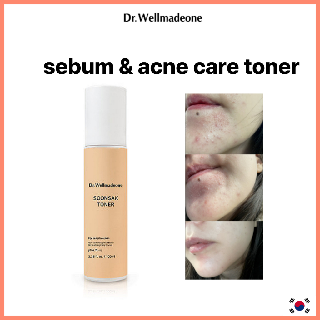[Dr.Wellmadeone] SoonSak Toner for sensitive skin 100ml pH Balance 4.7 ลดการเกิดสิว โทนเนอร์สำหรับคน