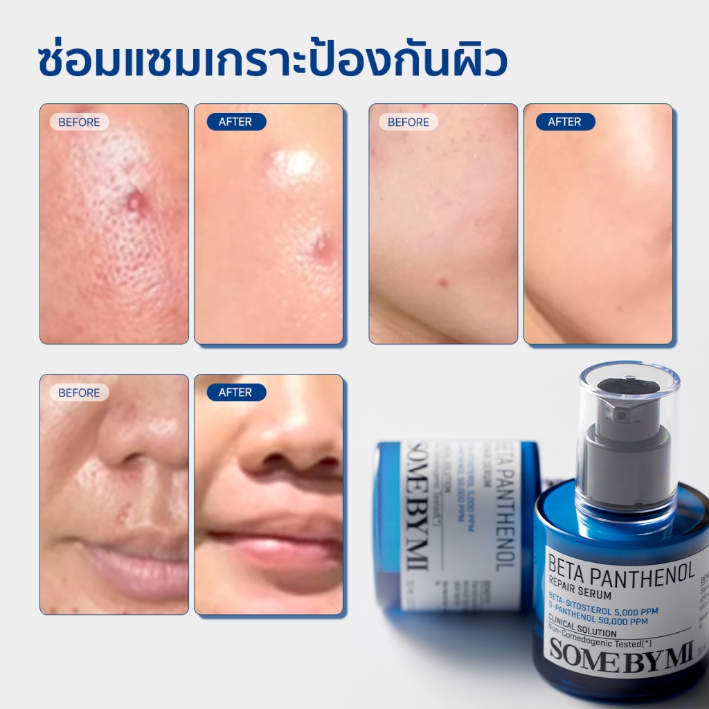 SOME BY MI Beta Panthenol Repair Serum [30ml], ฟื้นบำรุงเกราะป้องกันผิว, เซรั่มปลอบประโลมผิว - รูปที่ 5