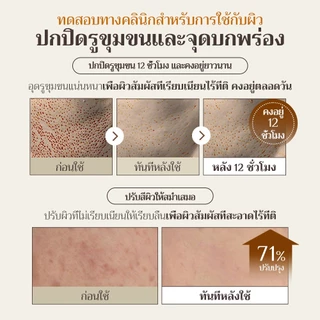 [OBgE Official] Natural Cover Lotion SPF50+ PA++++ 50g | โลชั่นปรับสีผิว | โลชั่นไม่วอก | โลชั่น 2 in 1 | ปกปิดปัญหาผิวได้อย่างรวดเร็ว | ปกปิดรูขุมขน & จุดด่างดำ | แคปซูลสี 4 เฉด | ปรับสีให้เรียบเนียนเป็นธรรมชาติ | ติดแน่นกับผิว