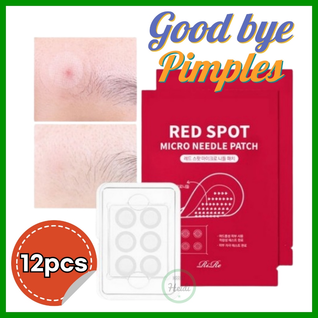 เกาหลี เกาหลี 🇰🇷 RIRE Red Spot Microneedle pimple patch / แผ่นแปะสิวพร้อมเข็ม