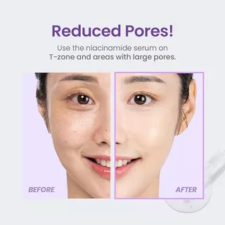 [TIRTIR] Niacinamide 20% SERUM 30ml (กระชับรูขุมขน ควบคุมความมัน)