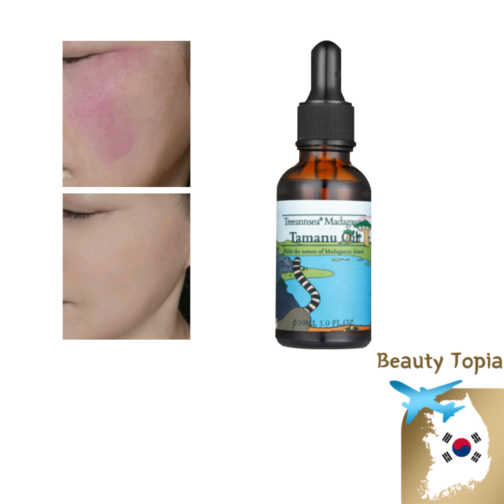 Treeannsea น้ำมันทามานูมาดากัสการ์ ครีมบำรุงผิว Madagascar Tamanu Oil 30มล ผ่อนคลายผิว face oil