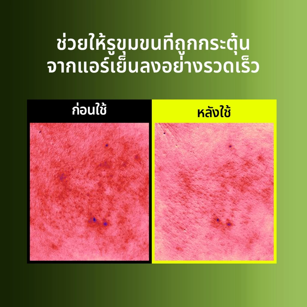 Beplain Mung Bean ครีมกระชับรูขุมขนถั่วเขียว 60ml | กระชับรูขุมขน ลดอุณหภูมิผิว สาเหตุรูขุมขนกว้าง | MUNG BEAN PORE TIGHT-UP SOOTHING CREAM thumbnail 6