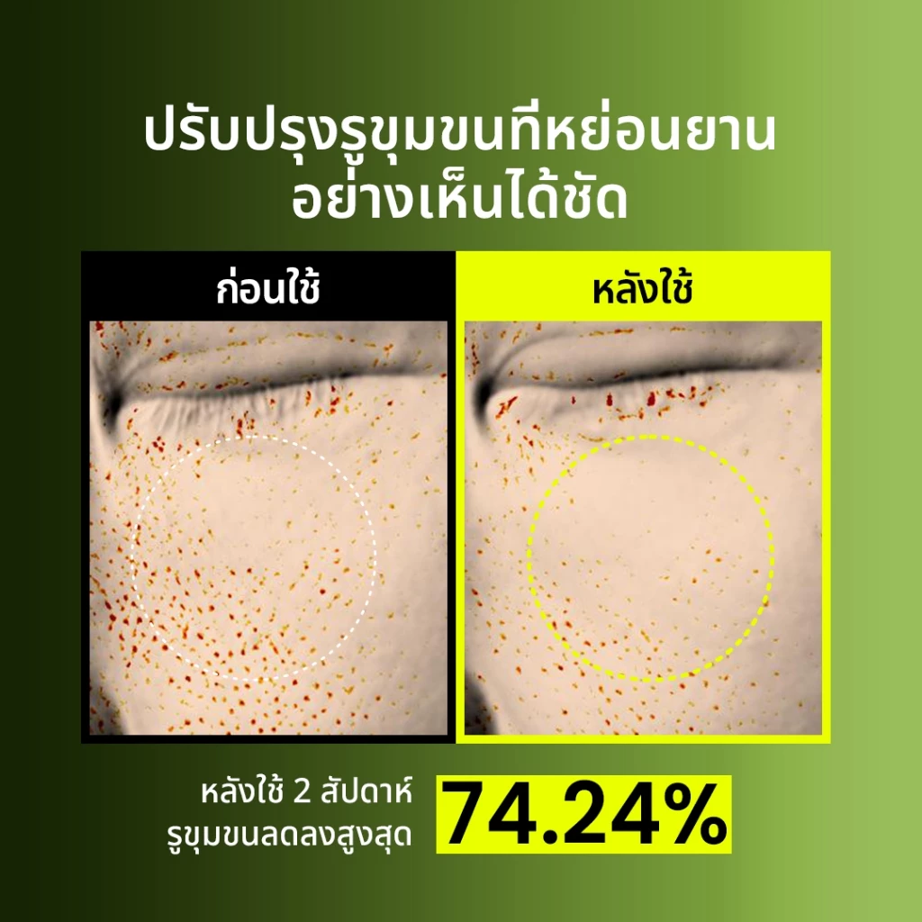 Beplain Mung Bean ครีมกระชับรูขุมขนถั่วเขียว 60ml | กระชับรูขุมขน ลดอุณหภูมิผิว สาเหตุรูขุมขนกว้าง | MUNG BEAN PORE TIGHT-UP SOOTHING CREAM thumbnail 7