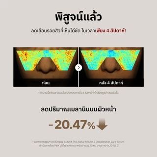 [COSRX OFFICIAL] The Alpha-Arbutin 2 Discoloration Care Serum 50ml. ดิ อัลฟ่า-อาร์บูติน 2 ดิสโคโลเรชั่น แคร์ เซรั่ม จัดการฝ้าแดด รอยสิว จุดด่างดำ