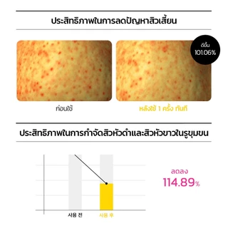 [Official] MEDIHEAL Vitamin C Pore Toning Cleanser (120ml) - โฟมล้างหน้าสูตรไบรท์เทนนิ่ง ทำความสะอาดล้ำลึก อ่อนโยนต่อผิว