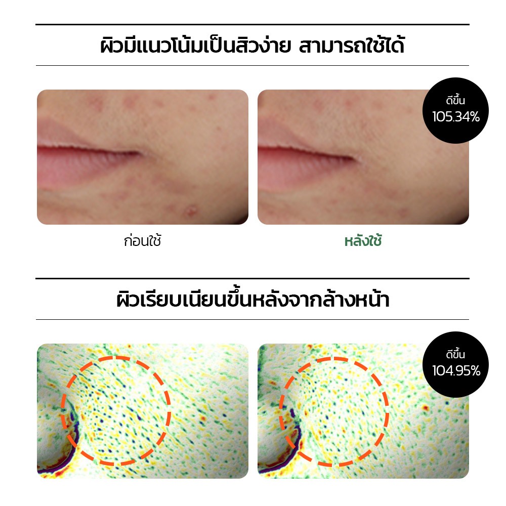 [Official] MEDIHEAL Teatree Trouble Calming Cleanser (120ml) - โฟมล้างหน้าสูตรแก้ปัญหาสิว อ่อนโยน ผิวแพ้ง่ายใช้ได้ - รูปที่ 2