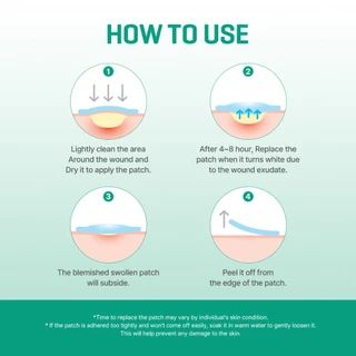 Some BY MI Clear Spot Patch [5ea/10ea], แผ่นแปะลดการระคายเคือง, แผ่นแปะสิว
