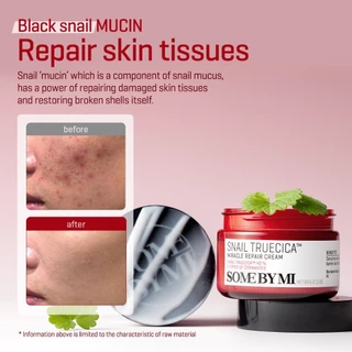 SOME BY MI Snail Truecica Miracle Repair Cream [60g], ลดการระคายเคืองอย่างมีประสิทธิภาพ, ครีมดูแลรอยสิว