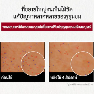 [CNP] Derma Answer Pore Firming Ampoule 15ML/30ML – Tightens Pores & Smooths Skin Texture | แอมพูลกระชับรูขุมขน | LG Beauty OFFICIAL