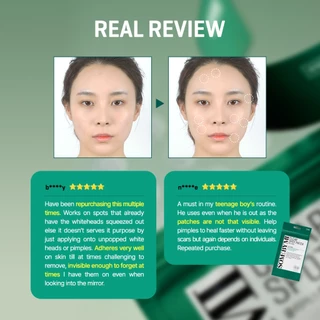 Some BY MI Clear Spot Patch [5ea/10ea], แผ่นแปะลดการระคายเคือง, แผ่นแปะสิว