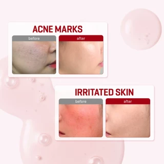 SOME BY MI Snail Truecica Miracle Repair Serum [50ml], เซรั่มดูแลรอยสิว