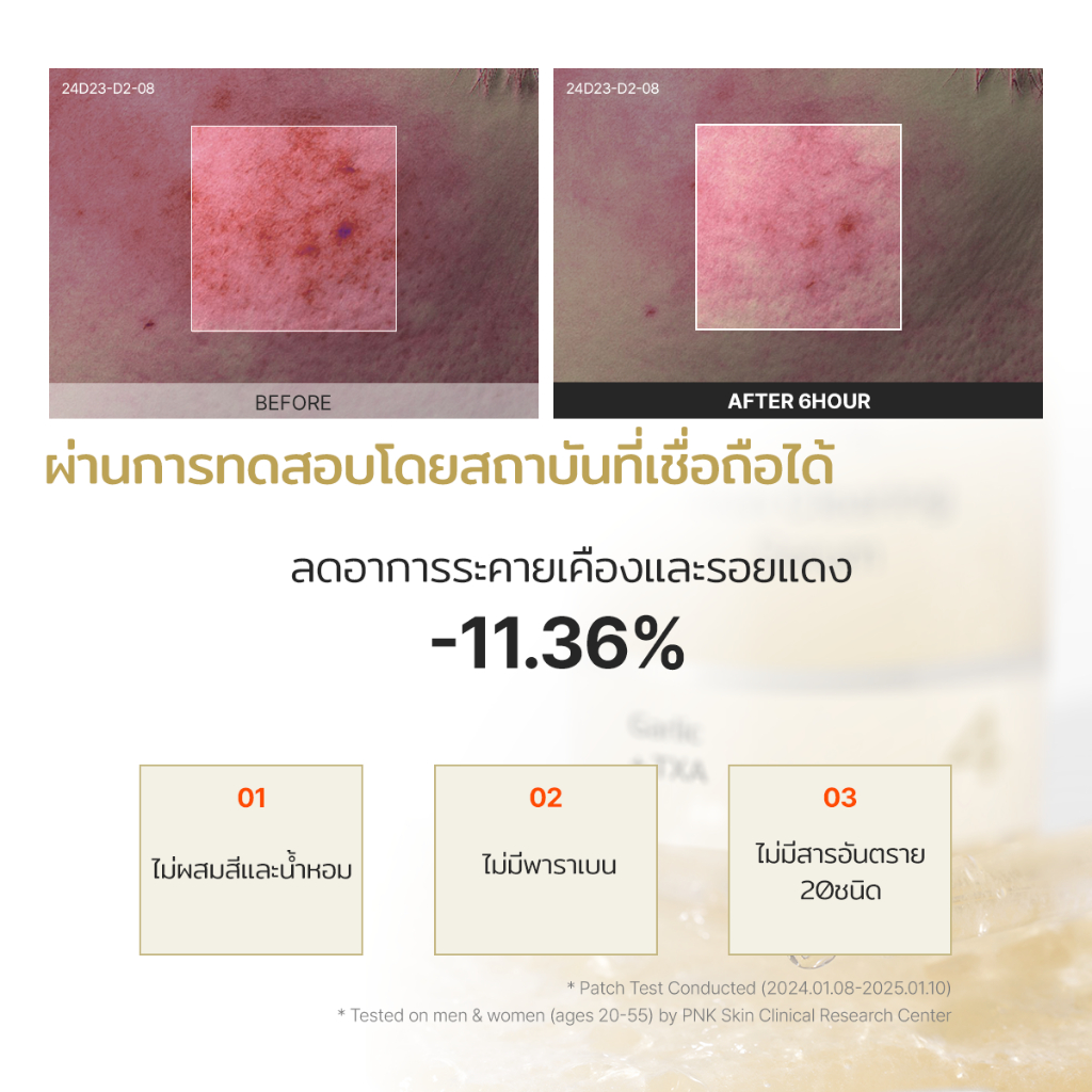 [P.CALM] Garlic TXA 4 Skin Clearing Serum 30ml เซรั่มกระเทียมTXA ลดอักเสบและรอยดำ ราคา ถูกที่สุด ดีลบีเคเค แกลเลอรีภาพที่ 7