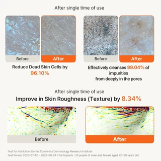 papa recipe Blemish Enzyme Powder Cleanser (50ml)