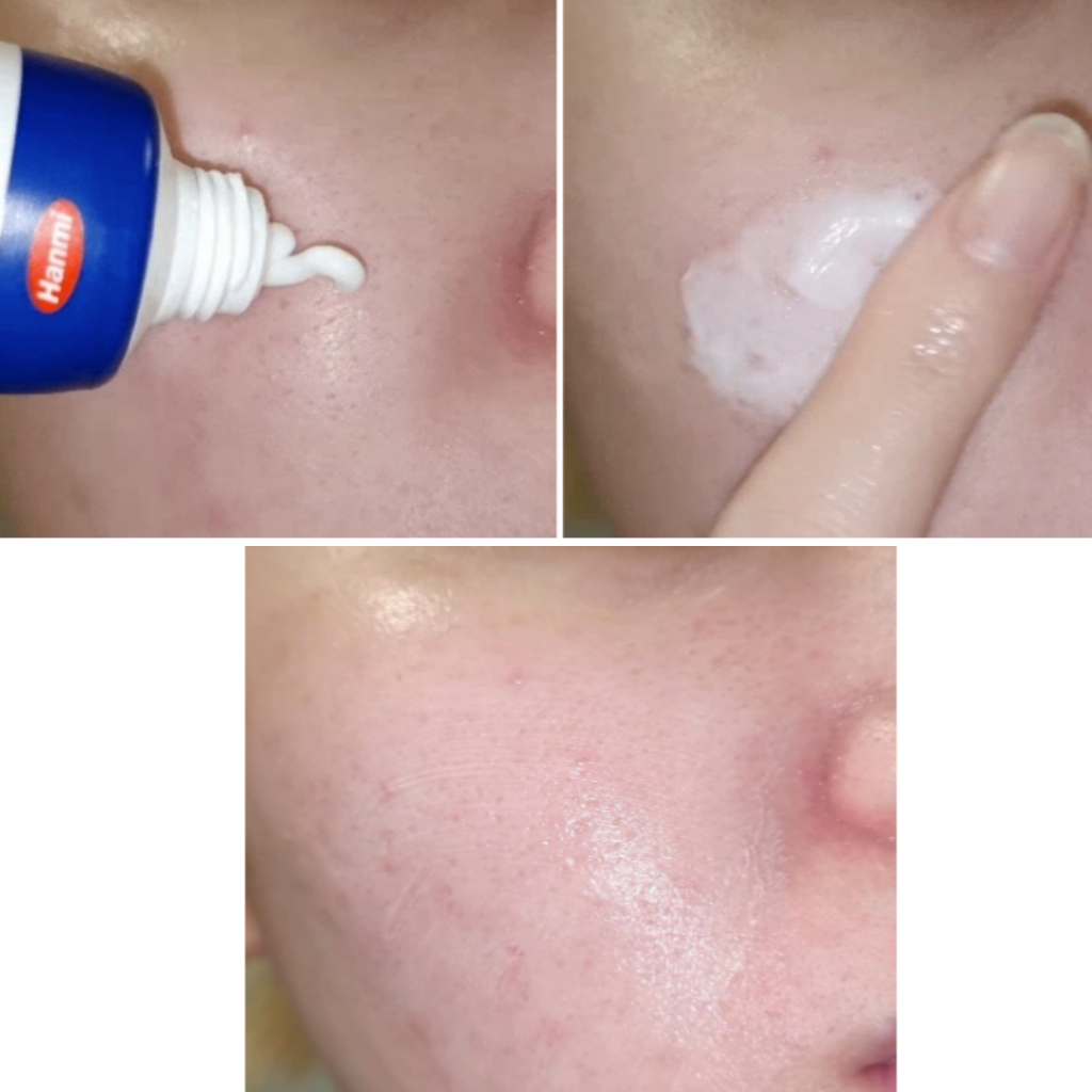 Hanmi Pharm PRO CALM Fusimedi (Repair Shot Ampoule, ครีมซ่อมแซม, มาส์กซ่อมแซม) - รูปที่ 4