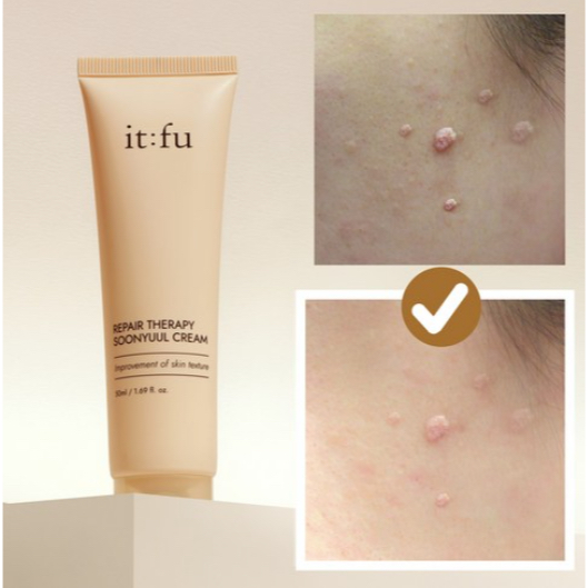 It;fu SOONYUL Cream – Jobs Tears & Collagen Texture Care, 50ml (1 ชิ้น)