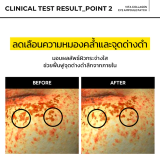 MEDIHEAL OFFICIAL Vita Collagen Eye Ampoule Patch(60ea) บริเวณรอบดวงตาฝ้าและหมองคล้ํา การปรับปรุงโทนด้วย Niacinamide และวิตามินซี
