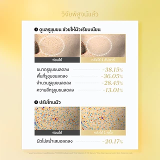 [COSRX OFFICIAL] โฉมใหม่ The Vitamin C 13 20ml เดอะ วิตามิน ซี 13 เซรั่ม (ซุปเปอร์ วิตามิน อี + ไฮยาลูโรนิค แอซิด)
