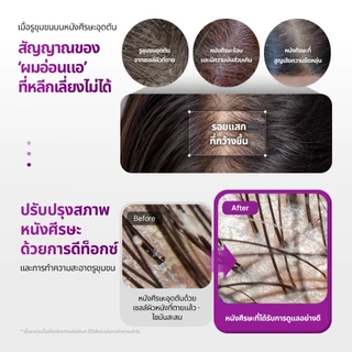 [VT] Reedle Shot Peptide Hair Boosting Scaling Shampoo 500ml CICA REEDLE X Peptide Hair Loss Care Scalp Cleanser & Exfoliaation [ห้างสรรพสินค้าอย่างเป็นทางการ]