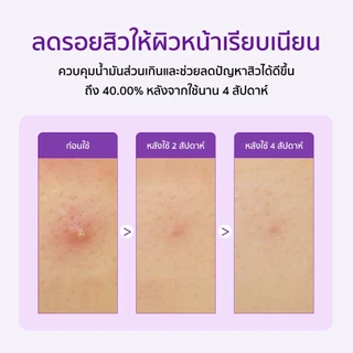 SOME BY MI Retinol Intense Reactivating Serum [50ml], เซรั่มเรตินอล, ผิวกระจก