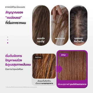 [VT] Reedle Shot Peptide Hair Boosting Scalp Pack 250ml CICA REEDLE X Peptide Hair Loss care บํารุงผม [ห้างสรรพสินค้าอย่างเป็นทางการ]