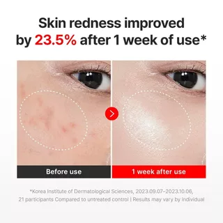 Centellian24 Madeca Cream Time Reverse 50ml +zero 80ml Moisturizer for Total Anti-Aging Solution