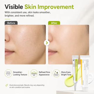 Celimax Pore+Dark Spot Brightening Cream 35ml ผิวแพ้ง่าย+The Vita Retinal Booster Anti-aging Duo