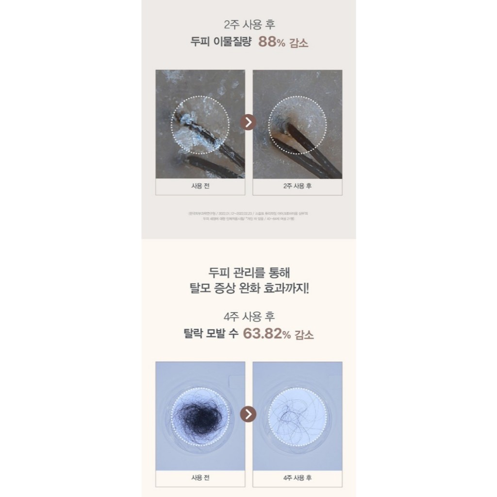 [107] Scalp Purifying Microbiome Shampoo 380ml RENEWED Virsion ราคา ถูกที่สุด ดีลบีเคเค แกลเลอรีภาพที่ 4