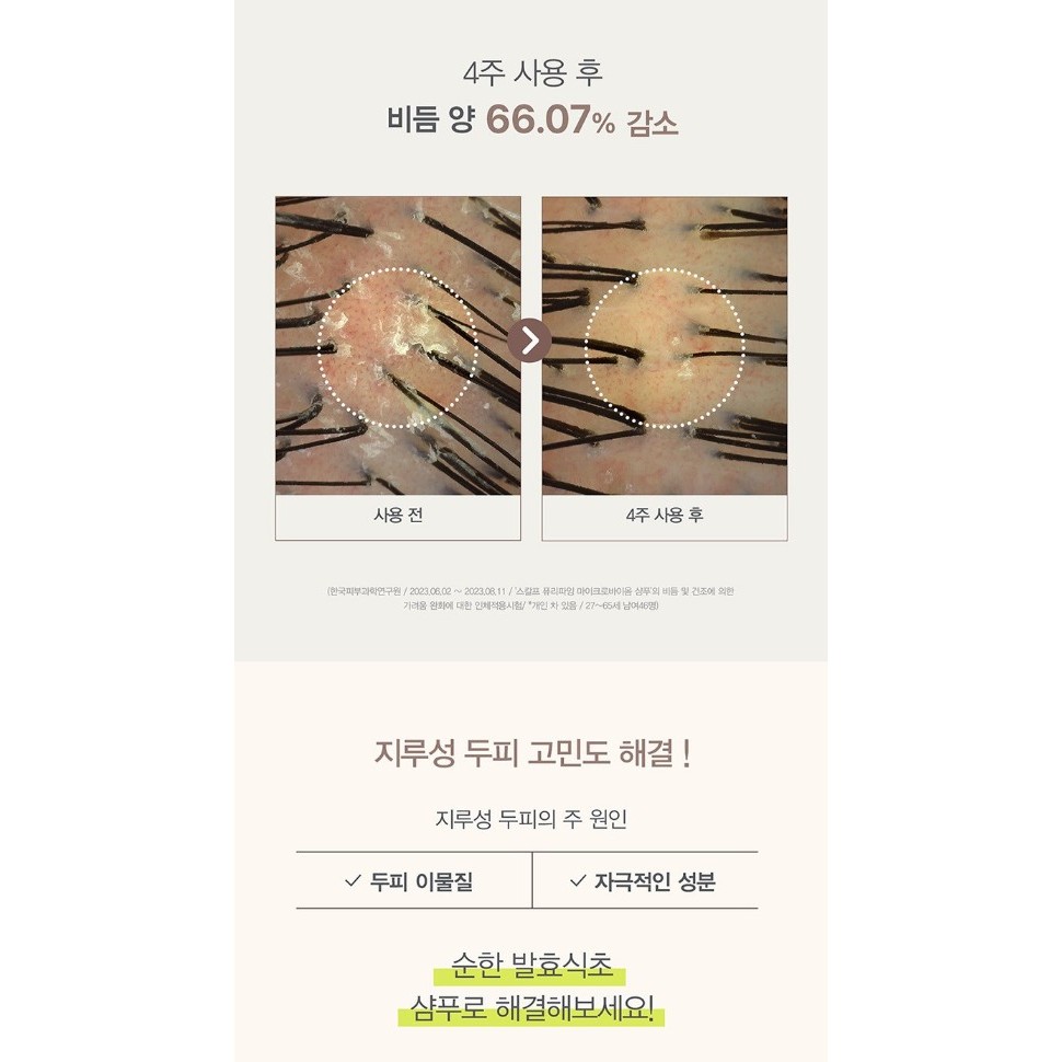 [107] Scalp Purifying Microbiome Shampoo 380ml RENEWED Virsion ราคา ถูกที่สุด ดีลบีเคเค แกลเลอรีภาพที่ 3