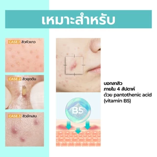 [Numbuzin Official] [Live Exclusive] มอยส์ + เซรั่มคุมมัน No.1 Pantothenic B5 SET Active Soothing Cream 80ml + Active Soothing Serum 50ml