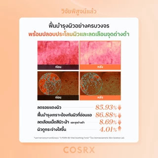 [COSRX OFFICIAL] 5 PDRN B5 Vital Soothing Toner 5 พีดีอาร์เอ็น บี5 ไวทัล ซูทติ้ง โทนเนอร์