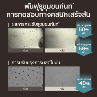 [OBgE Official] Black Head Scrub Balm 20g บาล์มสครับสิวหัวดํา 20g | ดูแลสิวหัวดําแบบครบวงจร | สครับสูตรอ่อนโยน | กระชับรูขุมขน | ขัดผิว | Skin Soothing & Moisturizing Effect