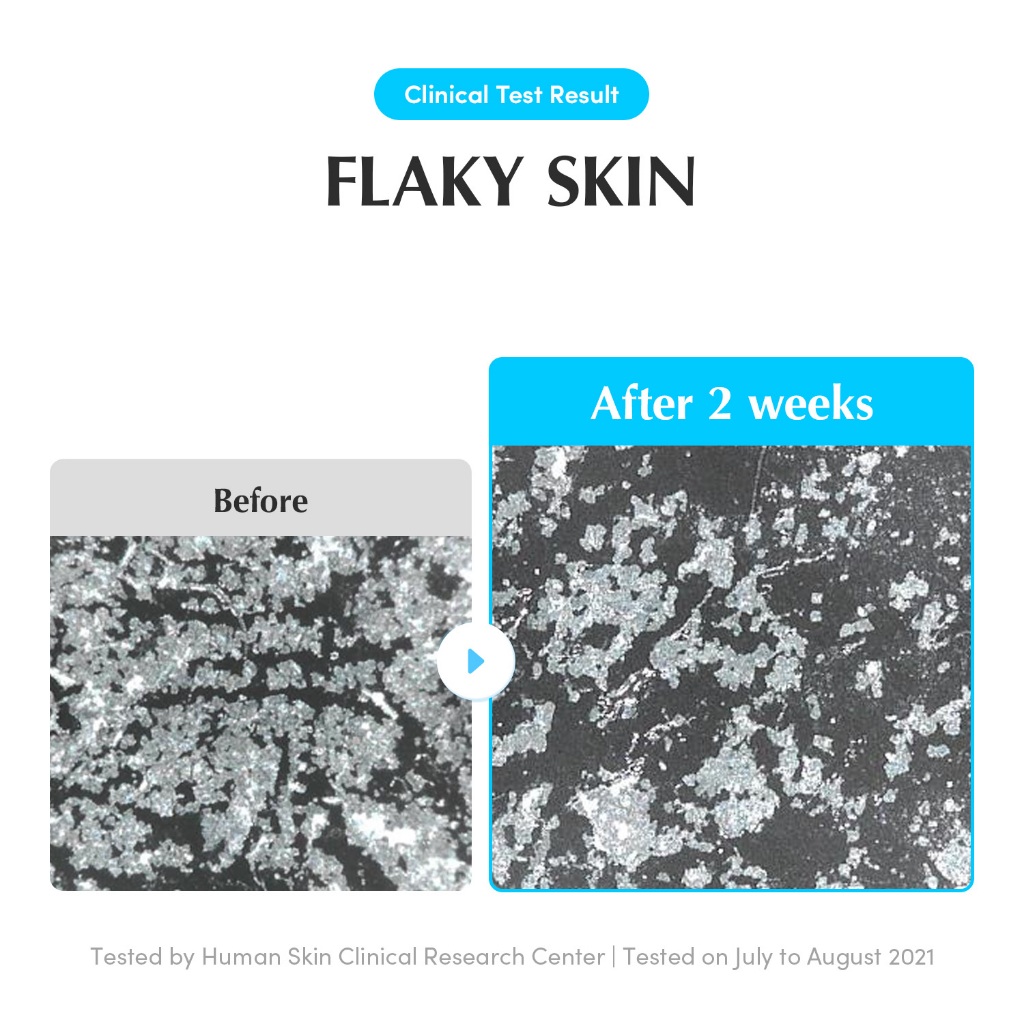 [EQQUALBERRY ของแท้] โทนเนอร์ SWIMMING POOL 300ml – ใช้ได้ทุกวัน ผลัดเซลล์ผิว อ่อนโยน ไม่มีสารเคมี - รูปที่ 4