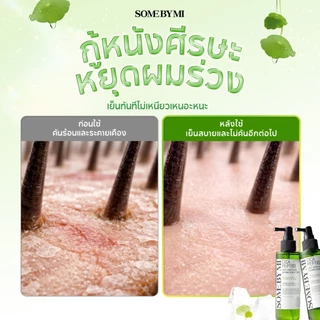 SOME BY MI Cica Peptide Anti Hair Loss Derma Scalp Tonic [150ml], สำหรับหนังศีรษะแพ้ง่าย, บรรเทาอาการผมร่วง