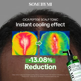 SOME BY MI Cica Peptide Anti Hair Loss Derma Scalp Tonic [150ml], สำหรับหนังศีรษะแพ้ง่าย, บรรเทาอาการผมร่วง