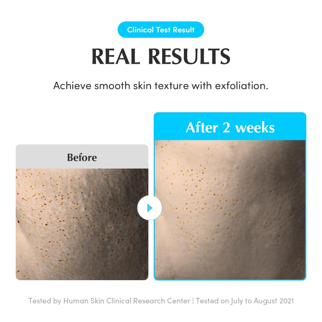 [EQQUALBERRY ของแท้] โทนเนอร์ SWIMMING POOL 300ml – ใช้ได้ทุกวัน ผลัดเซลล์ผิว อ่อนโยน ไม่มีสารเคมี - รูปที่ 5