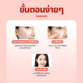 [Snow2+ Official] AC Magnesium patch (Mini 15 ชิ้น) / แผ่นแปะสิวไมโครนีดเดิลแมกนีเซียม / ฟื้นผิว 8 ชม. / แผ่นแปะเข็ม / แผ่นแปะสิว