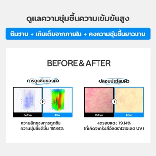 [NEW] MEDIHEAL Hyaluronate Ultra Hydration Essential Mask (4 แผ่น)