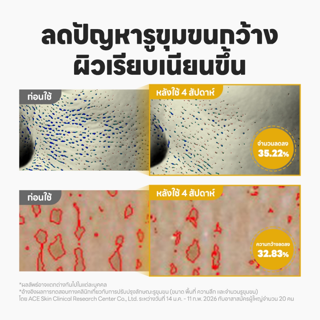 P.CALM كريم Active Retinoid 3000 Fade ‏20 غ — صورة 6