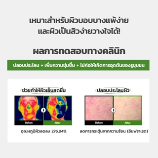 [NEW] MEDIHEAL Teatree Calming Moisture Essential Mask (4 แผ่น)