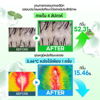 TH_SOME BY MI Cica Peptide Anti-Hair Loss Derma Scalp Serum 80ml