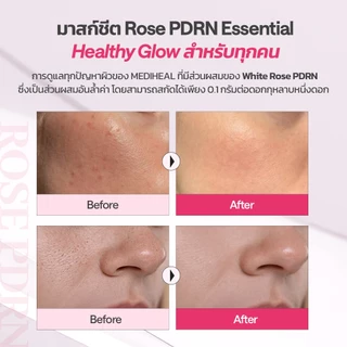 MEDIHEAL ROSE PDRN Essential Mask (4แผ่น) - กระชับรูขุมขน ผิวเรียบเนียน เติมความชุ่มชื้น
