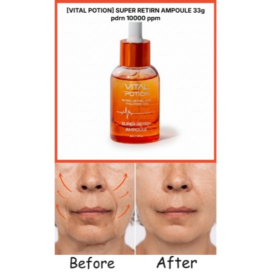 [Vital Potion] 1+1 Super Retinal N Ampoule 30ml | แซลมอน PDRN 1% + คอลลาเจน 61.4% | การดูแลยกกระชับ 