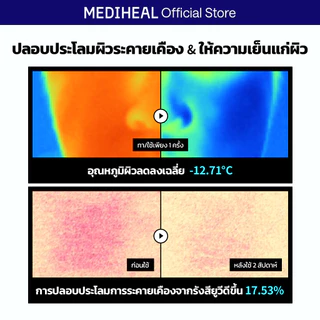 [NEW] MEDIHEAL BIO-SECONDERM MASK 4 แผ่น (Rose PDRN, Madecassoside, Hyaluronate)