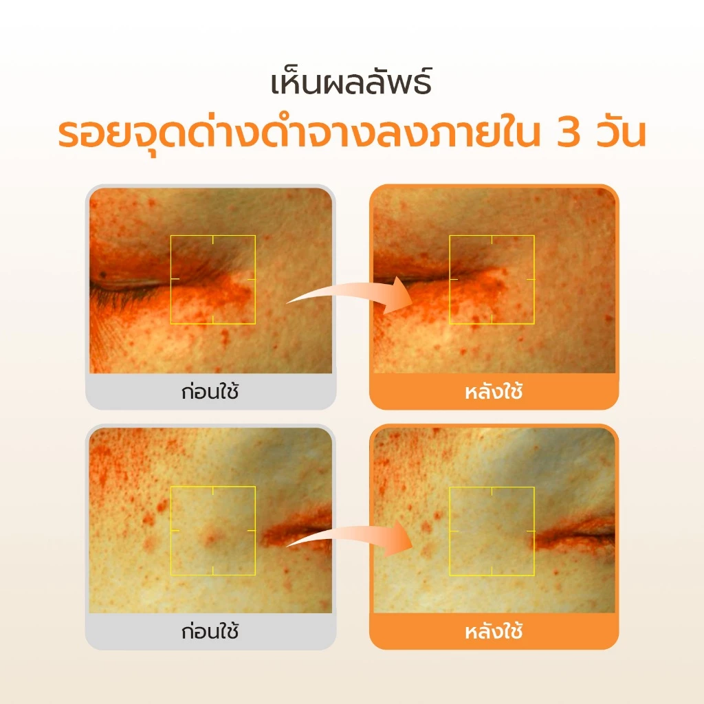 Abib Glutathiosome dark spot serum Vita drop (50ml)เซรั่มกลูต้าธิโอโซน พร้อมแคปซูลวิตามินซี ปรับผิวให้ดูสว่างใส ลดรอยดำ รอยสิว /ลดรอยดำ / ผิวกระจ่างใส / ไวท์เทนนิ่ง thumbnail 5