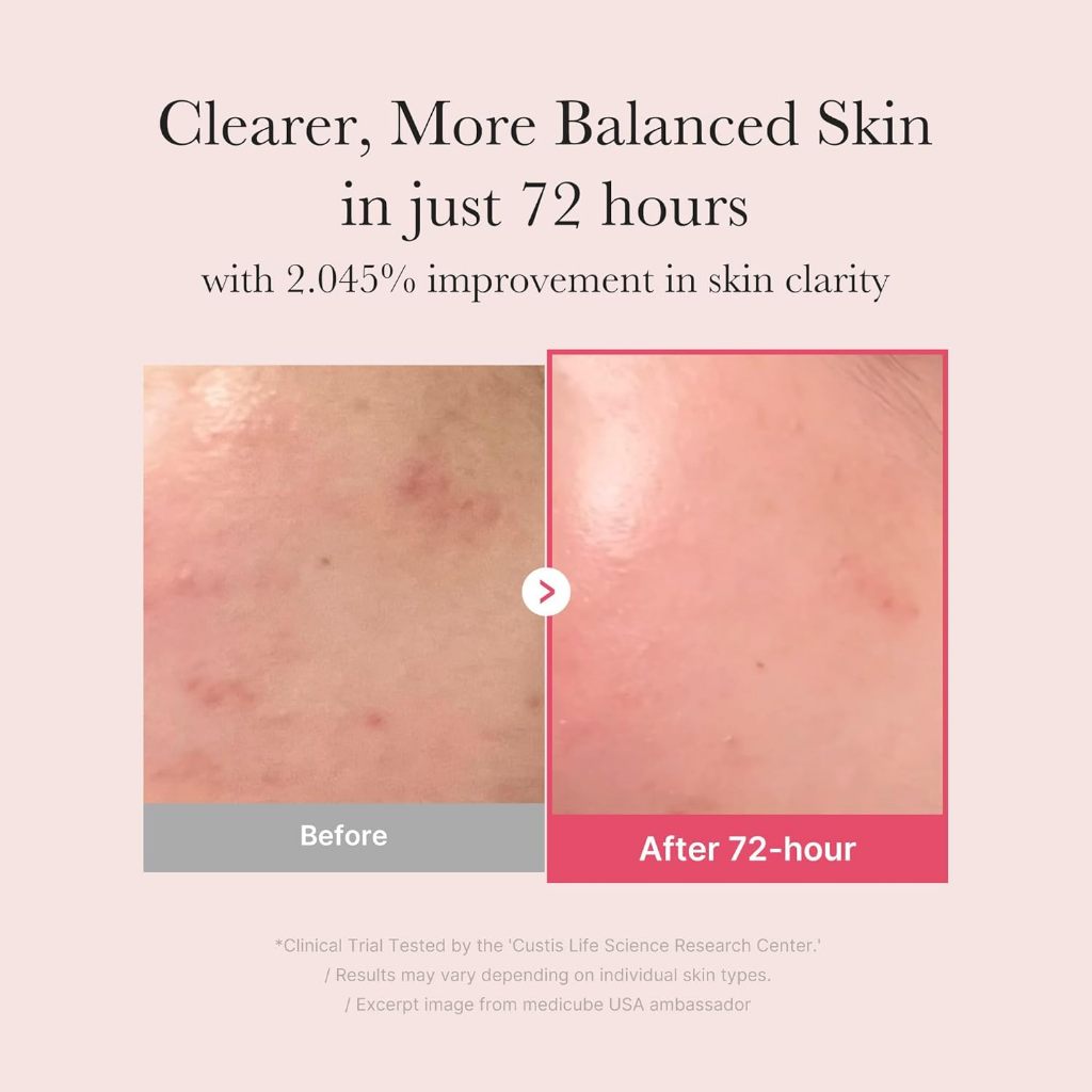 Medicube TXA+Niacinamide 15% Glow Facial Serum for After Spot Care ราคา ถูกที่สุด ดีลบีเคเค แกลเลอรีภาพที่ 3