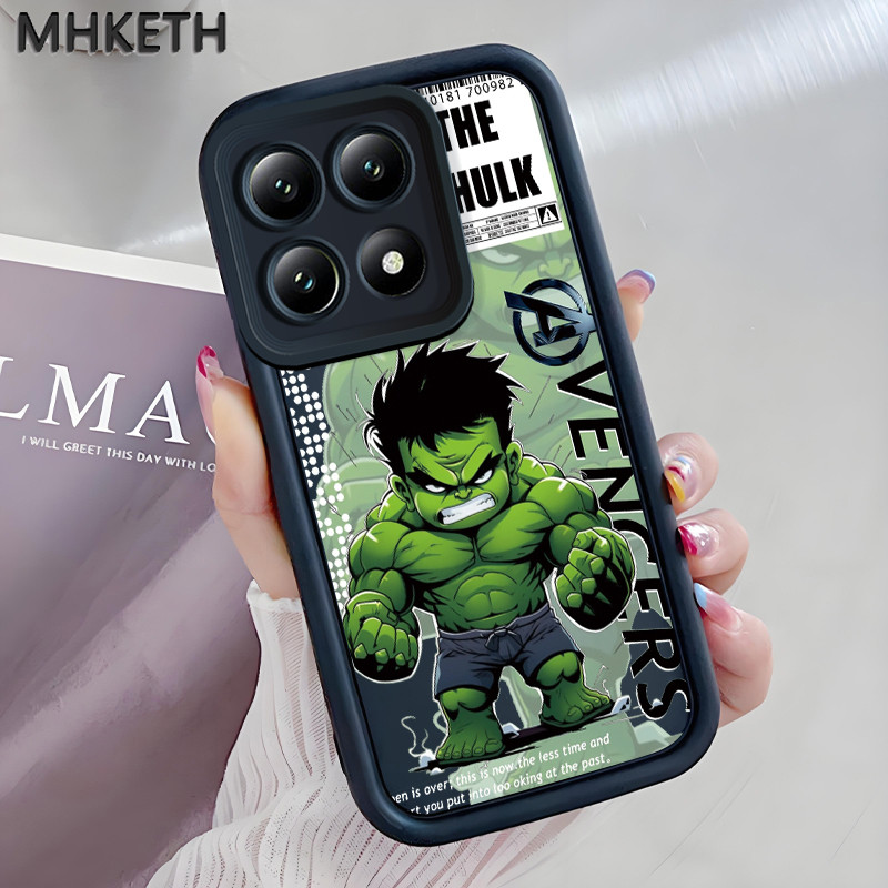 MHKETH เคสสำหรับ Xiaomi 14T 5G 14T Pro 5G เคสโทรศัพท์ออกแบบการ์ตูนยอดนิยมรุ่น Q
