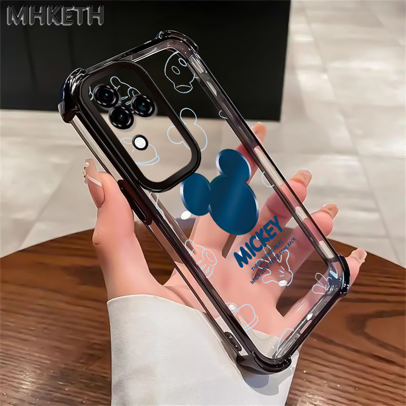 MHKETH เคสสำหรับ VIVO V30 5G V30 Pro 5G เคสโทรศัพท์สไตล์คู่รักน่ารักโปร่งใสชุบอิเล็กโทรเพลตกันกระแทก